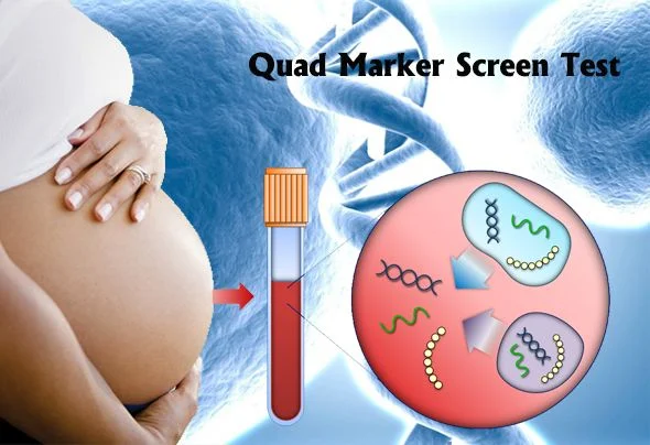 Second Trimester Quadruple Marker Test
